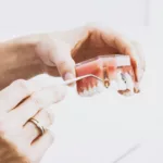 How to Master Dental Crown Glue Application in 30 Days