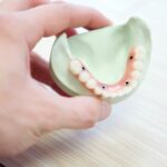 The Complete Guide to Temporary Dental Crowns