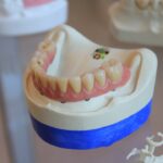The Definitive Guide to What Dental Crowns Look Like